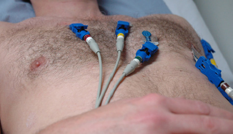 ECG recording