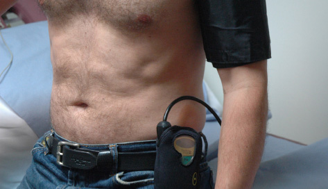 Blood pressure monitor