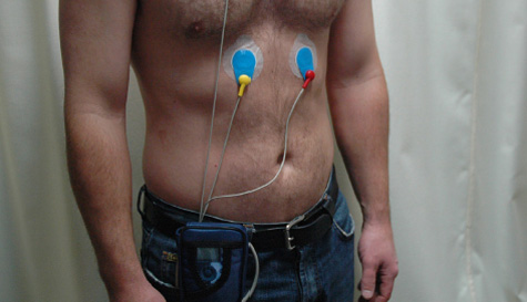24 hour Holter ECG monitor
